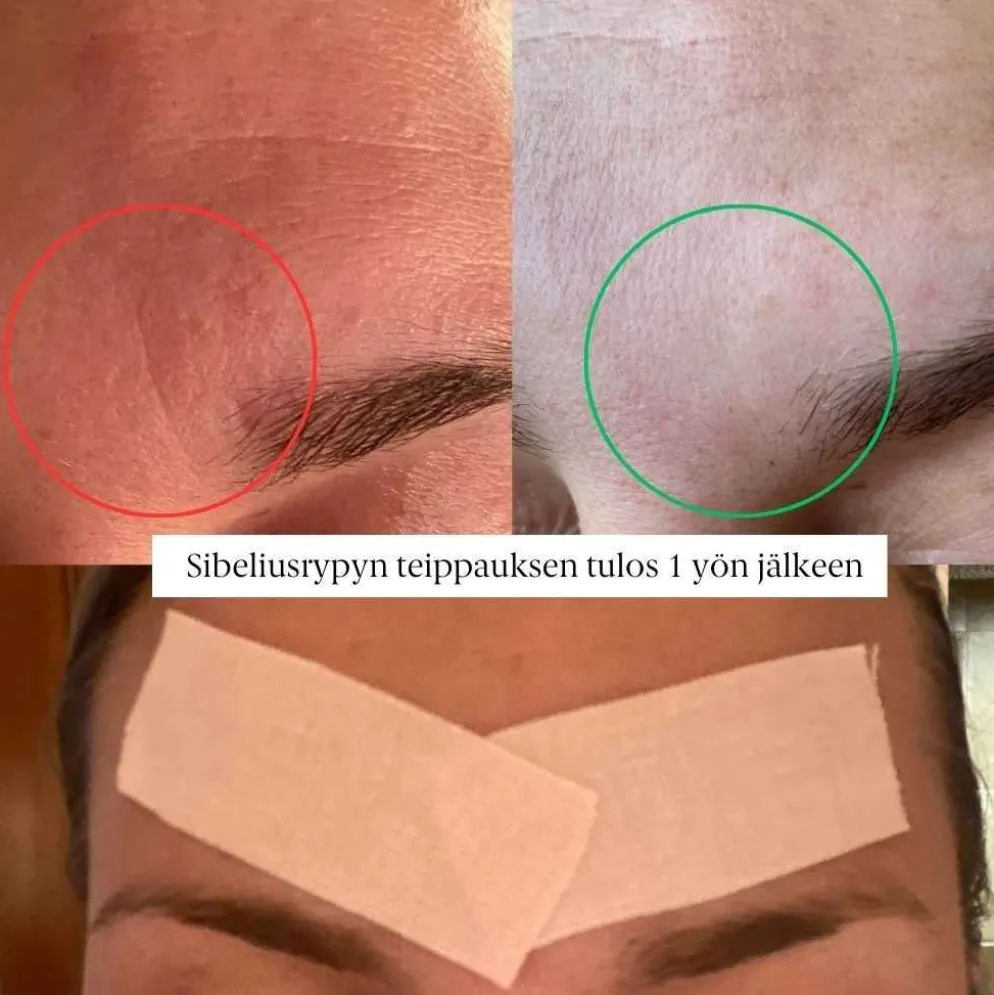 Faceimage kinesioteippi herkälle iholle, 2 eri kokoa